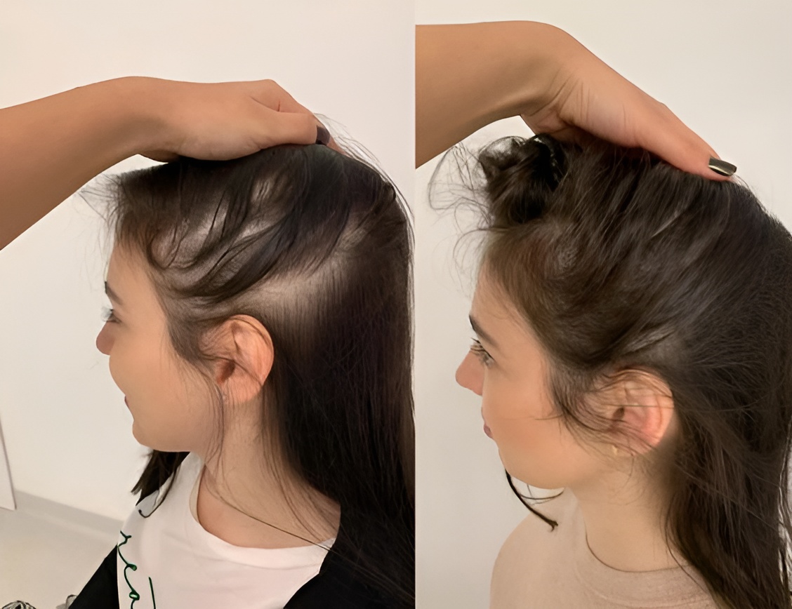 Hair Spa (Growth)